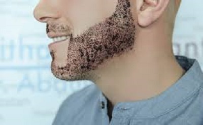greffe de barbe apres 10 jours
