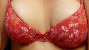 boule graisse apres lipofilling mammaire