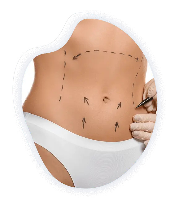 abdominal etching prix tunisie