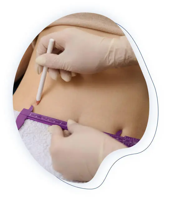 gravure abdominale tunisie