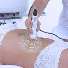 raffermissement radiofrequence