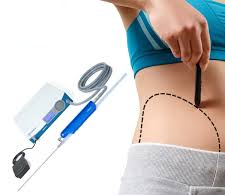 vibrofit liposuccion