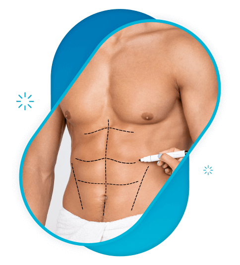 high definition abdominoplastie