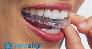 gingivectomie tunisie