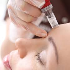 microneedling tunisie