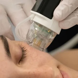 microneedling machine tunisie