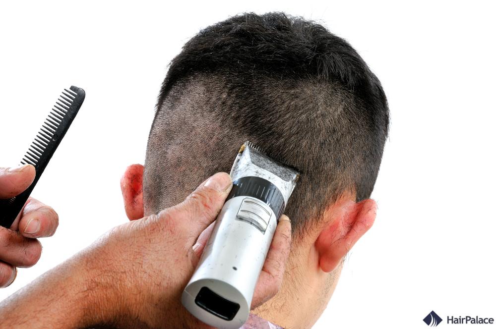 se raser la tête avant une greffe de cheveux
