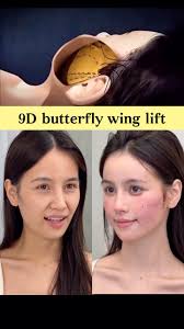 9D butterfly wing lift tunisie