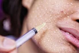 Skinbooster vs Mésothérapie pour hydrater la peau