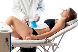 Cryolipolyse BodyTite liposuccion