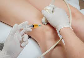 prp Médecine régénérative et orthopédique