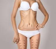 Liposuccion 3 zones Tunisie