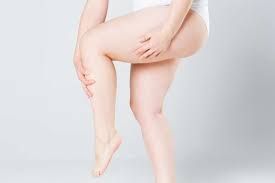 chirurgie lipoedeme liposucion confusion