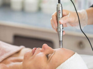 Collagen Induction Therapy