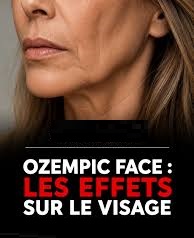 ozempic face