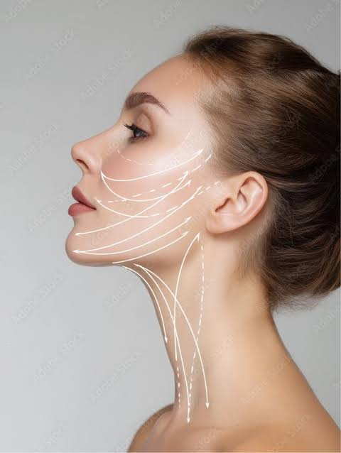Soft Tissue Fillers
