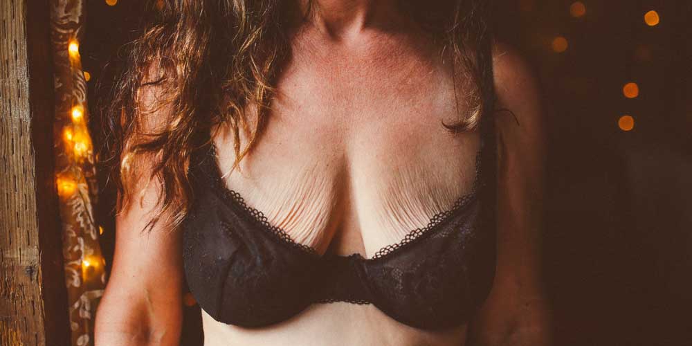 Seins tombants après une perte de poids