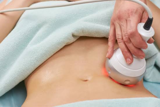 liposuccion assistee par energie